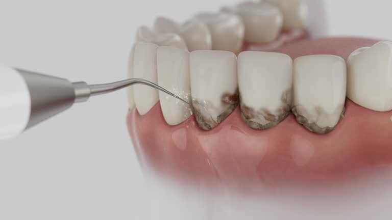 Reliable Dental contractor in Eastwood, MI by Dentist Open Now